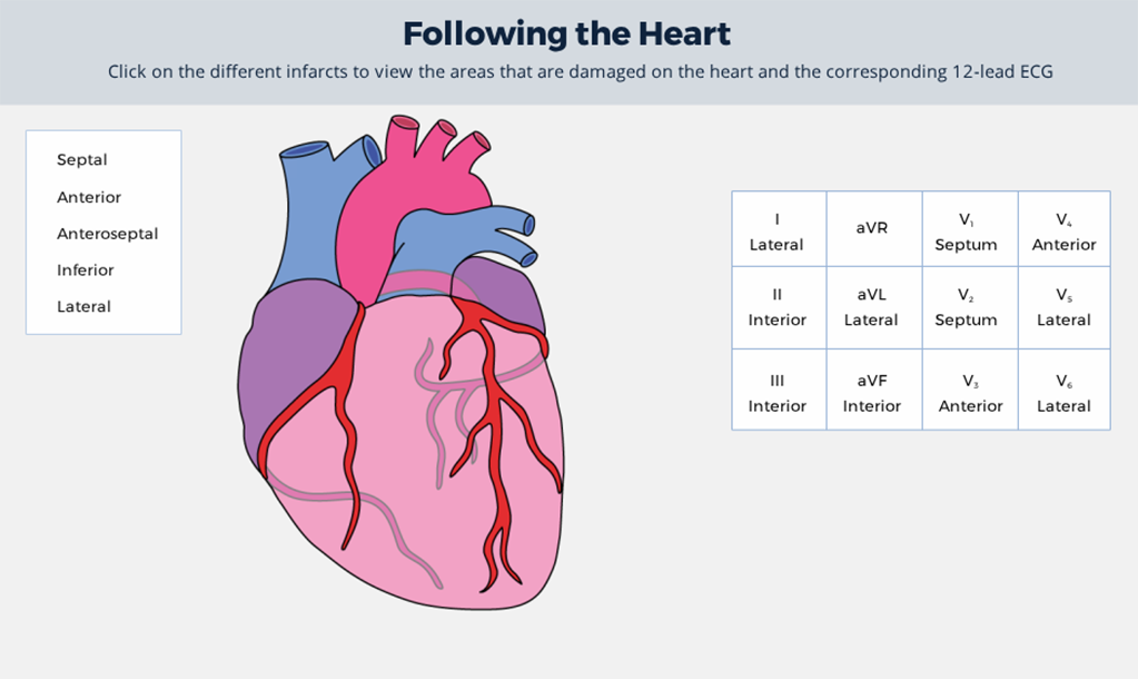 Following the heart interactivity screenshot